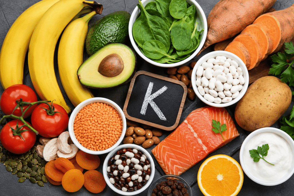 A selection of potassium-rich foods including bananas, spinach, avocados, potatoes, beans, tomatoes, yogurt, and salmon.